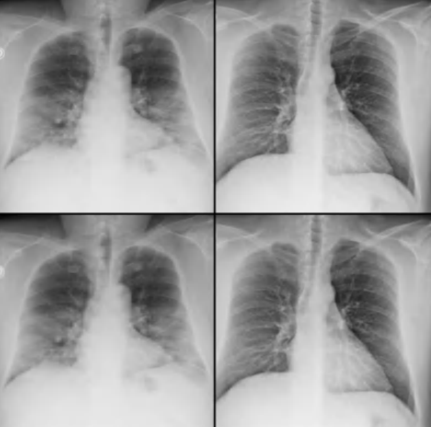 Deep Learning for Medical Imaging